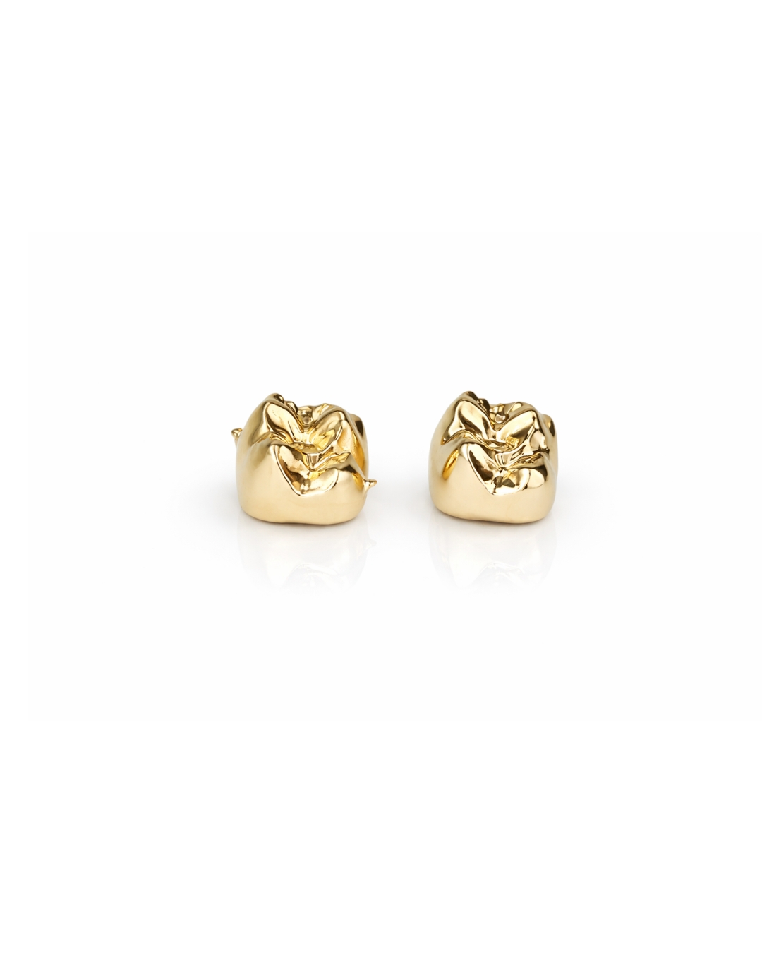 Full Gold Crown  -  strength and longevity